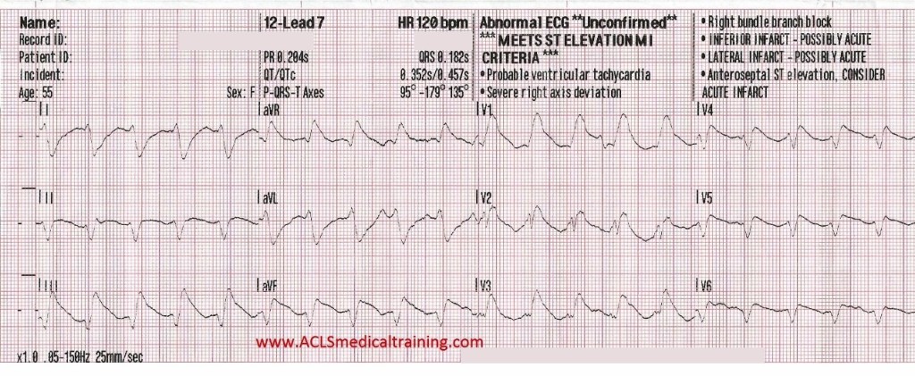 12-Lead 7 ECG