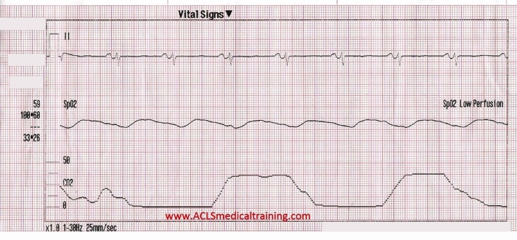 Vital Signs